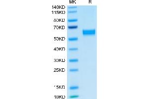 Human HGF on Tris-Bis PAGE under reduced condition. (HGF Protein (AA 32-728) (Fc Tag))