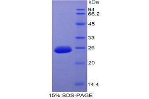 SDS-PAGE (SDS) image for Fibroblast Growth Factor 15 (FGF15) (AA 25-218) protein (His tag) (ABIN2121051)