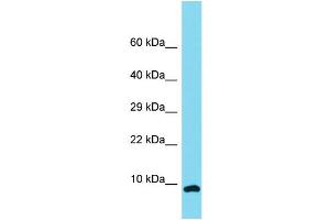 Host: Rabbit Target Name: C12orf75 Sample Type: NCI-H226 Whole Cell lysates Antibody Dilution: 1. (OCC-1 antibody  (N-Term))