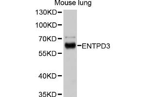 Western blot analysis of extracts of mouse lung, using ENTPD3 antibody (ABIN4903580) at 1:1000 dilution. (ENTPD3 antibody)
