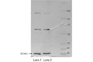RCAN1 antibody - middle region  validated by WB using MOUSE OSTEOCLASTS at 1:1000.