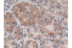 DAB staining on IHC-P; Samples: Human Stomach Tissue (P2RY14 antibody  (AA 51-303))