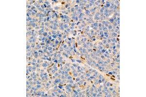 Immunohistochemistry of paraffin embedded mouse myeloma using MNDA (ABIN7074709) at dilution of 1:2000 (400x lens) (MNDA antibody)