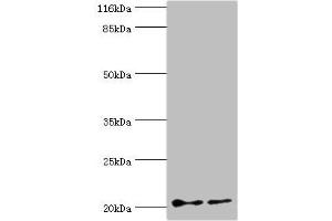 Western blot All lanes: UBE2C antibody at 2 μg/mL Lane 1: Hela whole cell lysate Lane 2: U87 whole cell lysate Secondary Goat polyclonal to rabbit IgG at 1/10000 dilution Predicted band size: 20, 16, 17, 18 kDa Observed band size: 20 kDa (UBE2C antibody  (AA 2-179))