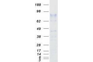 Validation with Western Blot (ZP2 Protein (Myc-DYKDDDDK Tag))