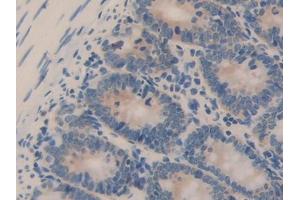 DAB staining on IHC-P; Samples: Rat Small intestine Tissue (Hsc70 antibody  (AA 534-615))