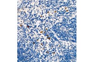 Immunohistochemistry of paraffin embedded mouse spleen using CCL3 (ABIN7073450) at dilution of 1:1000 (400x lens) (CCL3 antibody)