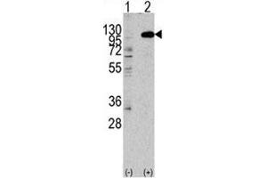 Western blot analysis of FGFR2 antibody and 293 lysate transiently transfected with the human gene.