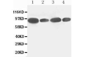 Western Blotting (WB) image for anti-Feline Sarcoma Oncogene (FES) (AA 808-822), (C-Term) antibody (ABIN3043015) (FES antibody  (C-Term))