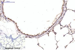 Immunohistochemical analysis of paraffin-embedded rat lung tissue. (NF-kB p65 antibody)