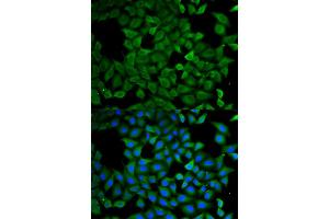 Immunofluorescence analysis of A549 cells using ATL1 antibody (ABIN5973048). (ATL1 antibody)