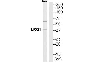 Western Blotting (WB) image for anti-Leucine-Rich alpha-2 Glycoprotein 1 (LRG1) (C-Term) antibody (ABIN1851480) (LRG1 antibody  (C-Term))