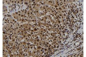 ABIN6262121 and ABIN6277702 at 1/100 staining Human liver tissue by IHC-P. (GSTP1 antibody  (N-Term))