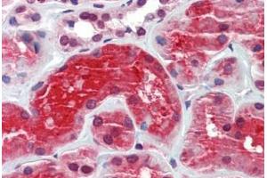 Human Kidney: Formalin-Fixed, Paraffin-Embedded (FFPE) (CRYM antibody)