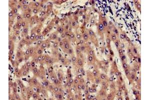 Immunohistochemistry of paraffin-embedded human liver tissue using ABIN7174495 at dilution of 1:100 (UBE2V2 antibody  (AA 2-145))