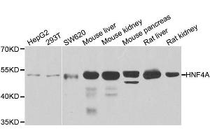 Western blot analysis of extracts of various cell lines, using HNF4A antibody. (HNF4A antibody  (AA 200-300))