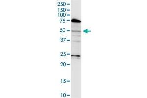 LASS3 monoclonal antibody (M02), clone 6C12. (LASS3 antibody  (AA 57-134))
