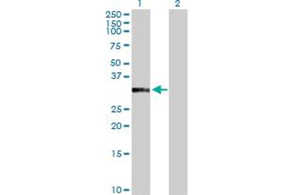 Annexin a10 antibody  (AA 1-324)