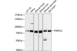 Western blot analysis of extracts of various cell lines, using P antibody (ABIN7269443) at 1:3000 dilution. (PARP12 antibody  (AA 462-701))