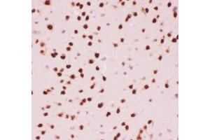 Anti-ATF2 Picoband antibody,  IHC(P): Mouse Brain Tissue (ATF2 antibody  (AA 93-450))