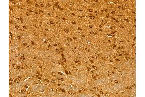 ABIN6262116 and ABIN6273047 at 1/100 staining Mouse brain tissue by IHC-P.