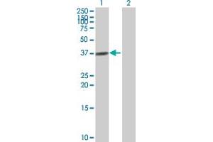 Western Blot analysis of ADH4 expression in transfected 293T cell line by ADH4 MaxPab polyclonal antibody. (ADH4 antibody  (AA 1-380))