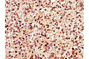 KCNJ1 antibody  (AA 165-379)