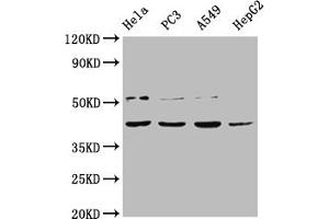Western Blot Positive WB detected in: Hela whole cell lysate, PC-3 whole cell lysate, A549 whole cell lysate, HepG2 whole cell lysate All lanes: DUX4 antibody at 1:2000 Secondary Goat polyclonal to rabbit IgG at 1/50000 dilution Predicted band size: 45 kDa Observed band size: 45 kDa (DUX4 antibody  (AA 217-402))