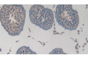 Detection of MMP3 in Rat Testis Tissue using Polyclonal Antibody to Matrix Metalloproteinase 3 (MMP3) (MMP3 antibody  (AA 278-450))