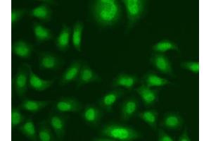 Immunofluorescence analysis of A549 cells using CETN2 antibody. (CETN2 antibody  (AA 1-172))