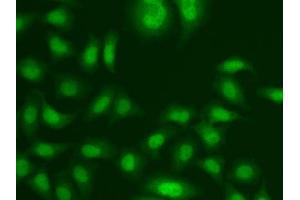 Immunofluorescence analysis of A549 cells using CETN2 antibody. (CETN2 antibody  (AA 1-172))