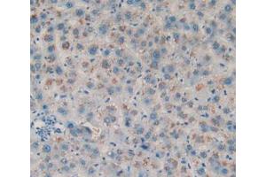 DAB staining on IHC-P; Samples: Human Liver Tissue (Amphiregulin antibody  (AA 20-100))