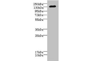 Western blot All lanes: CACNA2D2 antibody IgG at 4. (CACNA2D2 antibody  (AA 20-200))