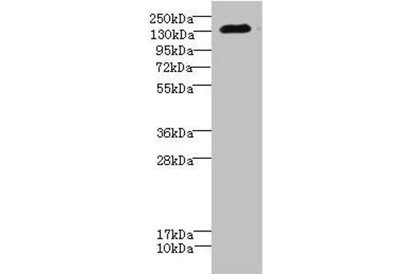 CACNA2D2 anticorps  (AA 20-200)