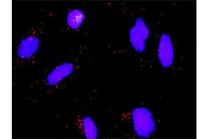 Proximity Ligation Analysis of protein-protein interactions between MSH2 and E2F3. (E2F3 antibody  (AA 336-425))
