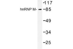 Image no. 1 for anti-Heterogeneous Nuclear Ribonucleoprotein M (HNRNPM) antibody (ABIN317716) (HNRNPM antibody)