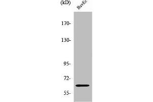Western Blot analysis of HuvEc cells using ZNF329 Polyclonal Antibody (ZNF329 antibody  (Internal Region))