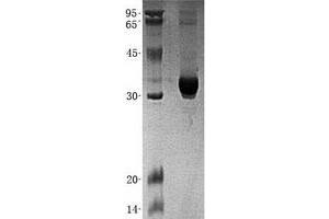 Validation with Western Blot (GNMT Protein (His tag))