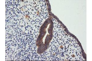 Image no. 6 for anti-Cancer/testis Antigen 1B (CTAG1B) antibody (ABIN1499889) (CTAG1B antibody)