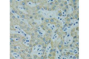 Immunohistochemistry of paraffin-embedded Human liver using STX1A Polyclonal Antibody at dilution of 1:100 (40x lens). (STX1A antibody)