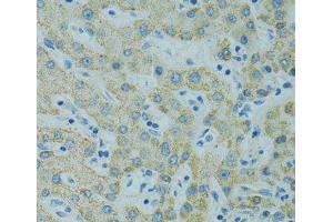 Immunohistochemistry of paraffin-embedded Human liver using STX1A Polyclonal Antibody at dilution of 1:100 (40x lens). (STX1A antibody)