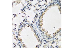Immunohistochemistry of paraffin-embedded mouse lung using BMP2 antibody. (BMP2 antibody  (AA 283-396))