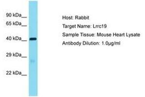 Image no. 1 for anti-Leucine Rich Repeat Containing 19 (LRRC19) (AA 251-300) antibody (ABIN6750321) (LRRC19 antibody  (AA 251-300))