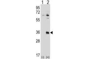 Western blot analysis of TSSK6 (arrow) using rabbit polyclonal TSSK6 Antibody (N-term) . (TSSK6 antibody  (N-Term))