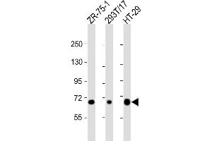 All lanes : Anti-SLC28A1 Antibody (Center) at 1:2000 dilution Lane 1: ZR-75-1 whole cell lysate Lane 2: 293T/17 whole cell lysate Lane 3: HT-29 whole cell lysate Lysates/proteins at 20 μg per lane. (SLC28A1 antibody  (AA 381-409))