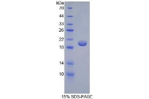 SDS-PAGE (SDS) image for Glucokinase (Hexokinase 4) Regulator (GCKR) (AA 91-286) protein (His tag) (ABIN1079647)