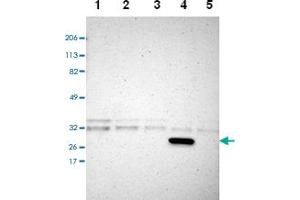 Western blot analysis of Lane 1: RT-4, Lane 2: U-251 MG, Lane 3: A-431, Lane 4: Liver, Lane 5: Tonsil with CREM polyclonal antibody.