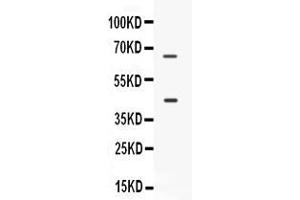 Western blot analysis of CD33 expression in SKOV3 whole cell lysates ( Lane 1). (CD33 antibody  (AA 18-259))