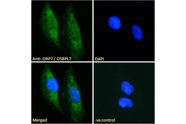 OSBPL7 antibody  (C-Term)
