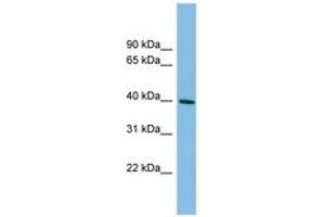 Image no. 1 for anti-Melanoma Antigen Family B, 4 (MAGEB4) (AA 35-84) antibody (ABIN6745113) (MAGEB4 antibody  (AA 35-84))